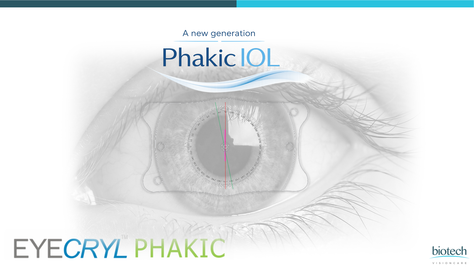 Eyecryl Phakic IOL